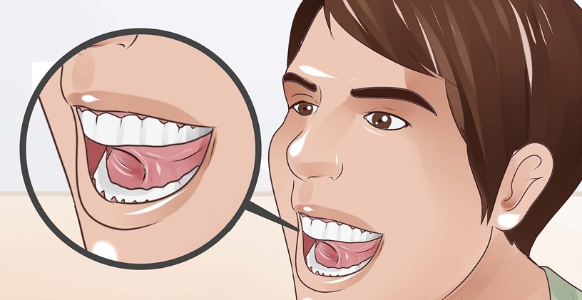 Lisping Sorunu: Neden Oluyor?