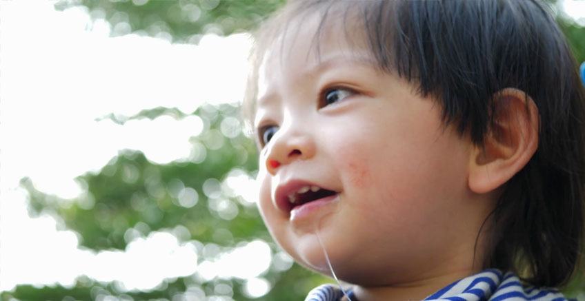 Ağız Sıvısı Akan Çocuklar ve Net Olmayan Konuşma