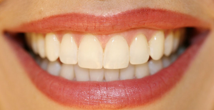 Yeme ve Yutmada Ağız ve Dişler