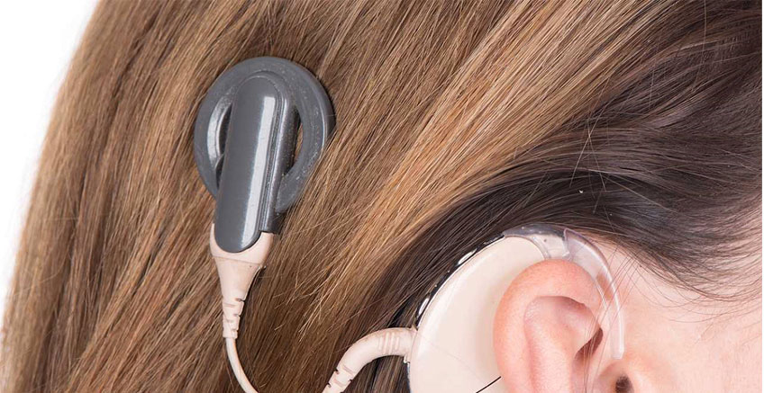 Koklear İmplantın Nasıl Kullanılacağını Öğrenme