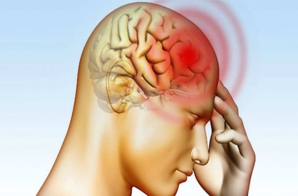 Kafa Yaralanmalarından ve Felçten Kaynaklanan Afaziyi Tedavi Eden DKT’ler