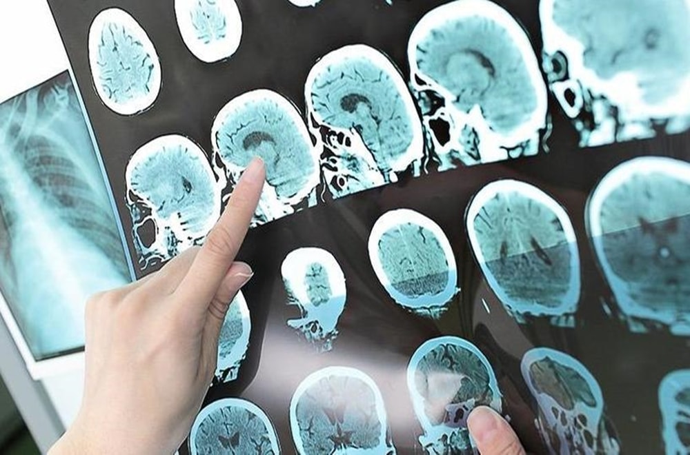 Kronik Bir Hastalıkla Yaşarken Esnek ve Uzaktan Çalışma