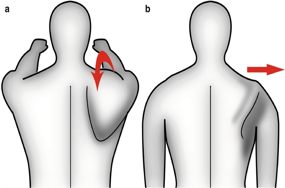 Skapular Diskinezi Sınıflandırması, Teşhisi, Yönetimi ve Müdahaleleri
